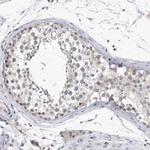 RBM28 Antibody in Immunohistochemistry (IHC)