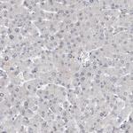 RBM28 Antibody in Immunohistochemistry (IHC)