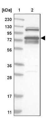 RBM28 Antibody in Western Blot (WB)