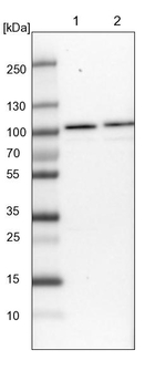 RBM28 Antibody in Western Blot (WB)