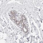 ERRF Polyclonal Antibody