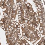CCDC132 Antibody in Immunohistochemistry (IHC)