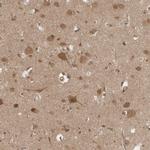 CCDC132 Antibody in Immunohistochemistry (IHC)