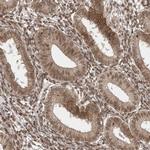 CCDC132 Antibody in Immunohistochemistry (IHC)