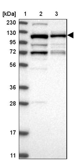 CCDC132 Antibody in Western Blot (WB)