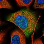 APRT Polyclonal Antibody