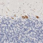 FGL2 Polyclonal Antibody