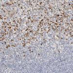 FGL2 Antibody in Immunohistochemistry (Paraffin) (IHC (P))