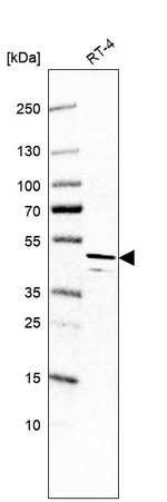 SH3GL2 Antibody in Western Blot (WB)