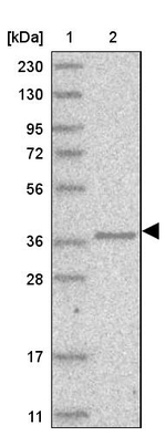 AASDHPPT Antibody in Western Blot (WB)
