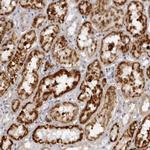 SUGCT Polyclonal Antibody