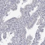SUGCT Antibody in Immunohistochemistry (IHC)