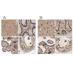 CBLL1 Antibody in Immunohistochemistry (IHC)