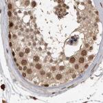 CBLL1 Antibody in Immunohistochemistry (IHC)