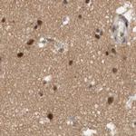 CBLL1 Antibody in Immunohistochemistry (IHC)