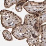 CBLL1 Antibody in Immunohistochemistry (IHC)