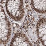 CBLL1 Antibody in Immunohistochemistry (IHC)