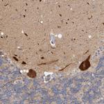 ZNF804B Polyclonal Antibody