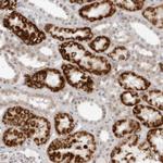 SUGCT Polyclonal Antibody