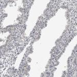 SUGCT Antibody in Immunohistochemistry (IHC)