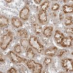 SUGCT Polyclonal Antibody