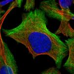 BZW2 Polyclonal Antibody