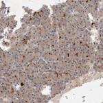 BZW2 Antibody in Immunohistochemistry (Paraffin) (IHC (P))