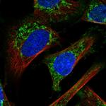 IMMP2L Polyclonal Antibody