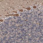 GIMAP6 Polyclonal Antibody