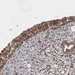 AOAH Polyclonal Antibody