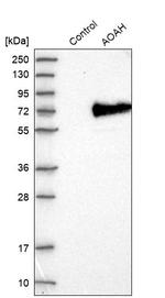 AOAH Antibody in Western Blot (WB)