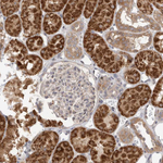 PRKAR1B Antibody in Immunohistochemistry (Paraffin) (IHC (P))