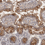 PRKAR1B Antibody in Immunohistochemistry (Paraffin) (IHC (P))