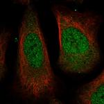 USP24 Polyclonal Antibody