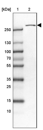 USP24 Antibody in Western Blot (WB)