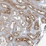 TNN Polyclonal Antibody