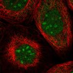 TRMT1L Polyclonal Antibody