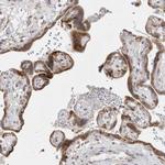 TRMT1L Antibody in Immunohistochemistry (Paraffin) (IHC (P))