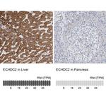 ECHDC2 Antibody