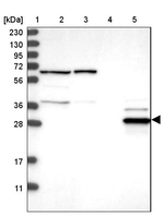 ECHDC2 Antibody in Western Blot (WB)