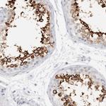 C9orf50 Antibody in Immunohistochemistry (IHC)