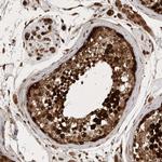 FAM221A Polyclonal Antibody