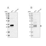 FAM221A Antibody in Western Blot (WB)