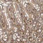 Tug Antibody in Immunohistochemistry (Paraffin) (IHC (P))