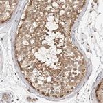 Tug Antibody in Immunohistochemistry (IHC)