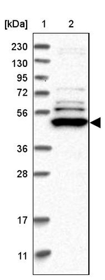 TRMT61B Antibody in Western Blot (WB)