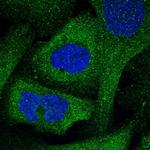 FAM221A Polyclonal Antibody