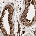 FAM221A Antibody in Immunohistochemistry (IHC)