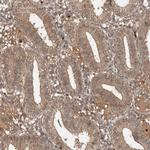 FAM221A Antibody in Immunohistochemistry (IHC)