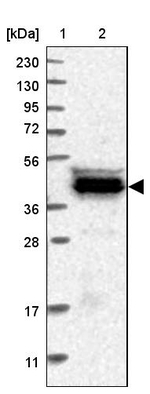 C9orf41 Antibody in Western Blot (WB)